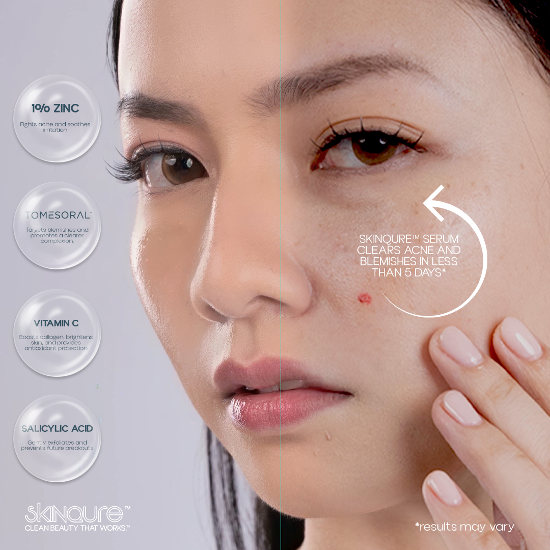 [1 bottle] SkinQure Anti-acne and Brightening Serum